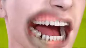 Straumann Implant Импланты ШТРАУМАН, Швейцария