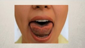 Артикуляционное упражнение Чашечка для языка. Артикуляционная гимнастика упражнение Чашечка