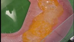 "О самом главном" от 26 01 2015 Хеликобактер пилори