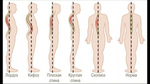 Окружающий мир 3 класс ч 1, тема урока Опора тела и движения, с 134 137, Школа