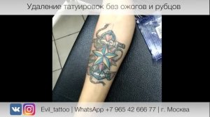 Лазерное удаление татуировки в студии Evil Tattoo. Без травм, ожогов и рубцов.