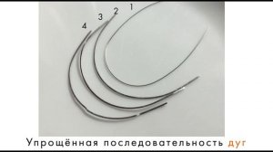 КАК РАБОТАЮТ БРЕКЕТЫ | Устройство брекет-системы