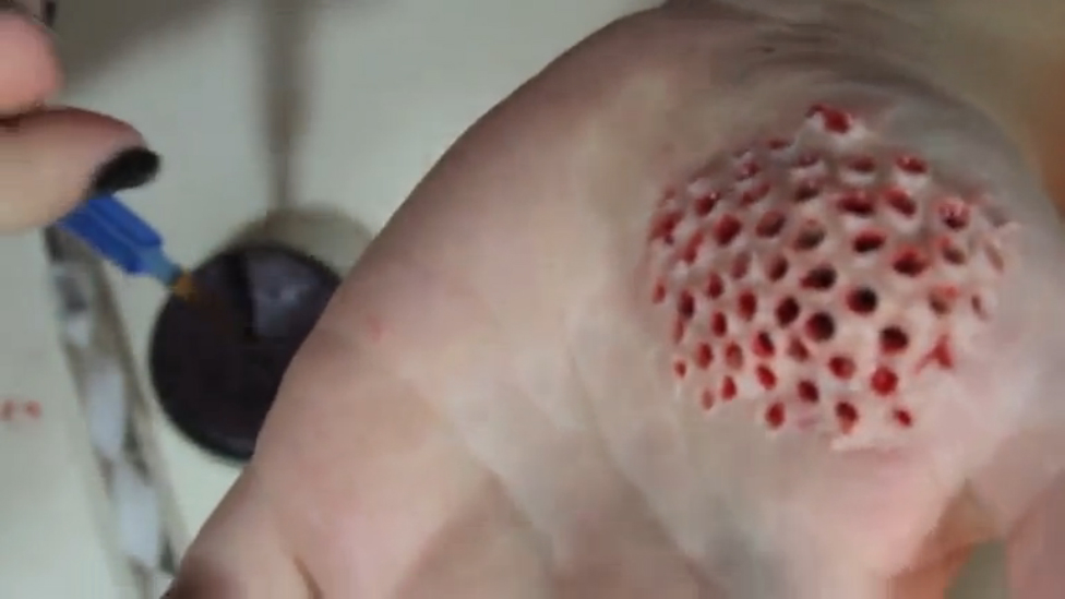 Maggot Infested Hand