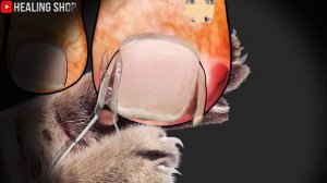 [ASMR] Zombie (athlete's foot + ingrown toenail) treatment (care) animation 'Tingle' /asmr