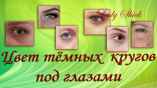 Тёмные круги под глазами: причины и можно ли их убрать.
