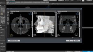 OnDemand 3D Dental from cbct to panoramic view. Делаем из клкт в панормный вид