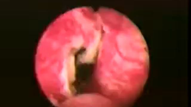 TUR ДГПЖ смотреть онлайн