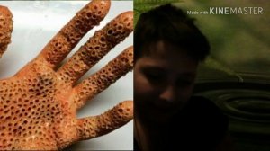 Очень мерзкая фобия. ТРИПОФОБИЯ(боязнь отверстий!!)