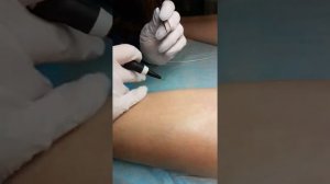 Электроэпиляция обучение