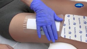 Наложение повязки Hydrofilm plus (инструкция)