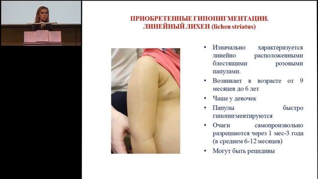18.02.2017 - Нарушения пигментации кожи у детей