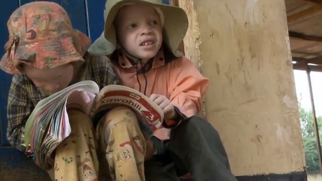 Что значит быть альбиносом в Танзании!