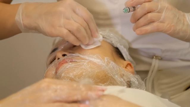 Биорепарация Aquashine BR - лицо и руки. Увеличение губ Juvederm Volbella. смотреть онлайн