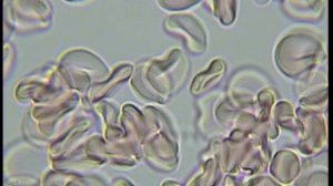 Кровь под микроскопом. Норма.