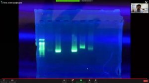 БИОХАКАТОН НТИ Лекция "Приготовление агарозного геля, электрофорез, визуализация ДНК в УФтрансиллюм