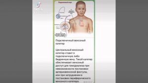 Медицина : Подключичный венозный катетер/07.09.21