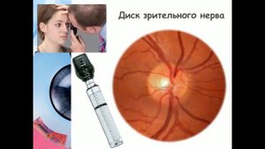 Анатомия сетчатки