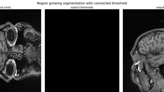 Medical Image Processing | Image Segmentation | Registration |  Morphological operations | python