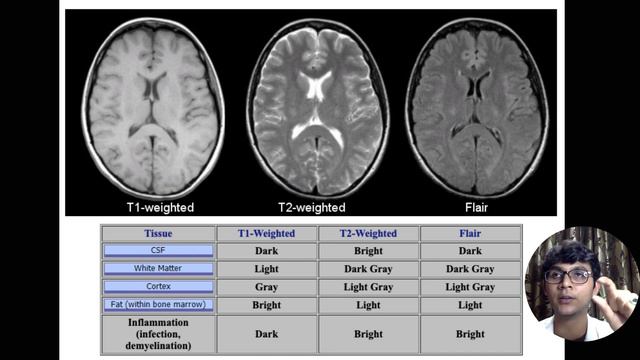 Understand the MRI basics (T1, T2, DWI, FLAIR) смотреть онлайн