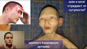 Жизнь мозга зависит от базилярной артерии, которая погибает из-за сутулой осанки. Упражнения для шеи