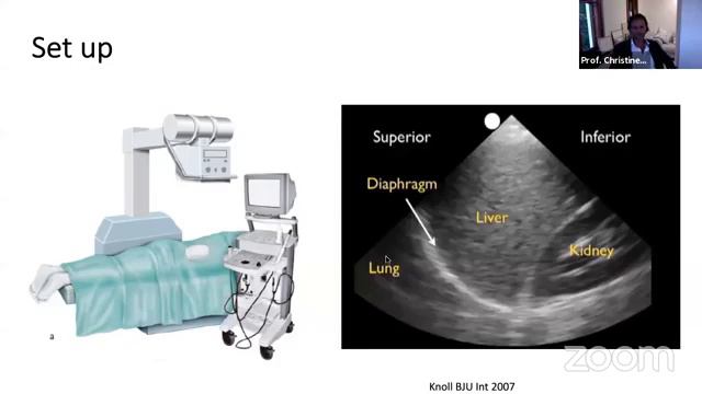 PCNL Access || Urology || смотреть онлайн