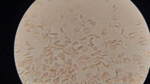 Влияние МИНЕРАЛЬНОЙ воды на кровь человека