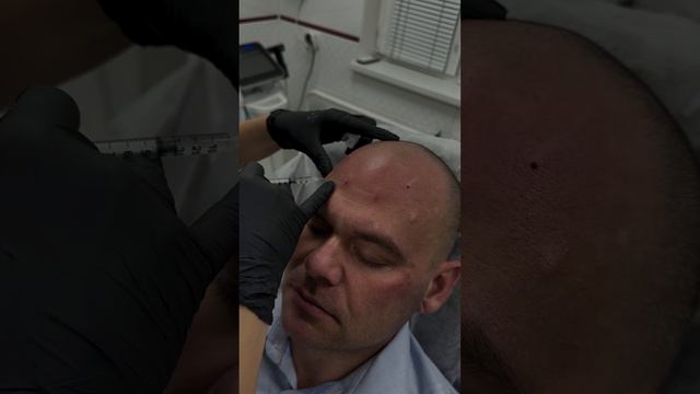 Мужчины тоже хотят стать моложе ✨