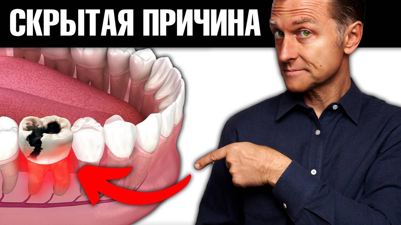 Скрытая причина инфаркта, о которой вы точно не знали... смотреть онлайн