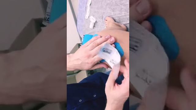 Кинезиотейпирование для стабилизации коленного сустава