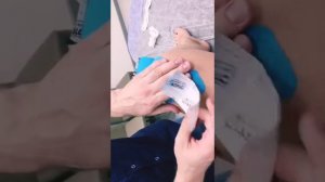 Кинезиотейпирование для стабилизации коленного сустава