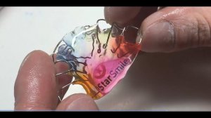 Изготовление пластинки для зубов - старые и болезненные технологии лечения прикуса