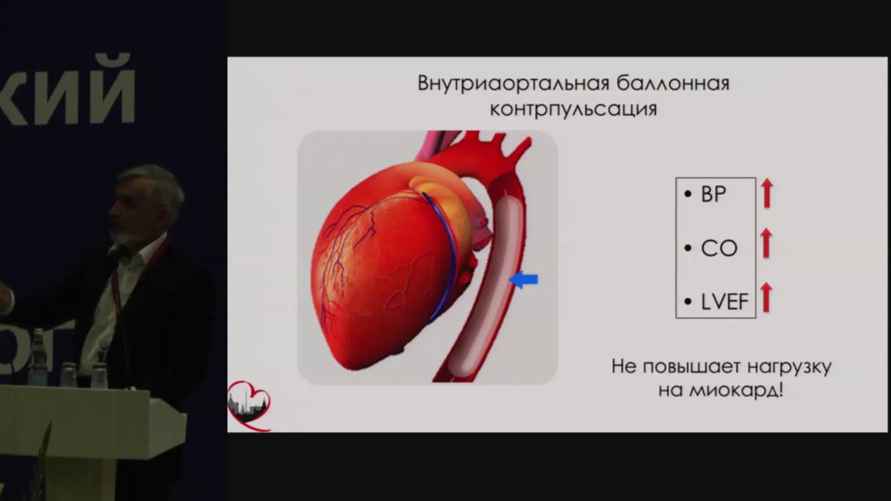 Шпектор А.В. Шок при остром инфаркте миокарда: дифференциальный диагноз и лечение | Инфаркт миокарда