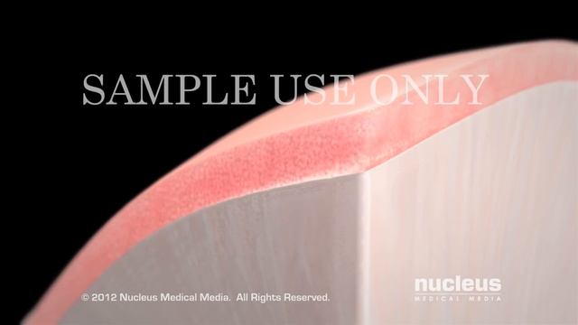 Lesión cerebral traumática leve смотреть онлайн