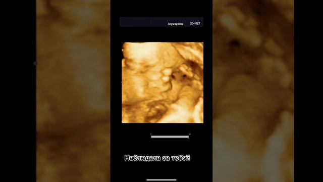 История моей беременности смотреть онлайн