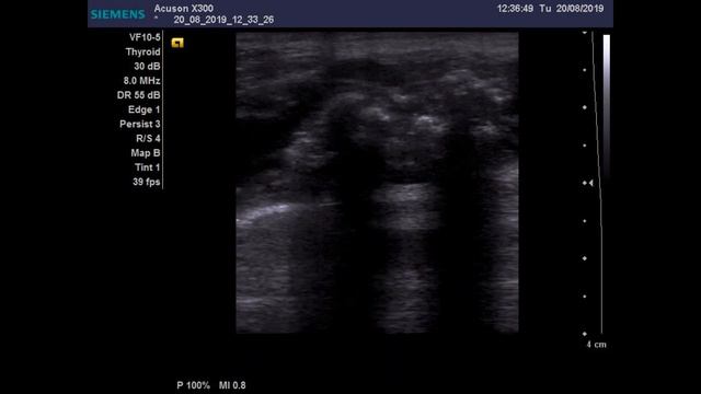 Обитатели кисты Бейкера смотреть онлайн