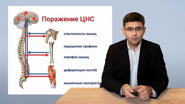 2 й выпуск Youtube-канала "СТОП.Спастичность" (инсульт, ЧМТ, ДЦП, рассеянный склероз, парез)