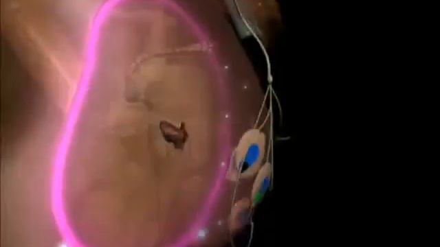 Dormed Hellas - Monica AN24 Fetal Monitor Portable смотреть онлайн