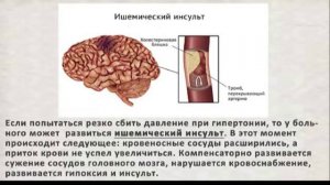 Повышенное давление у мужчин