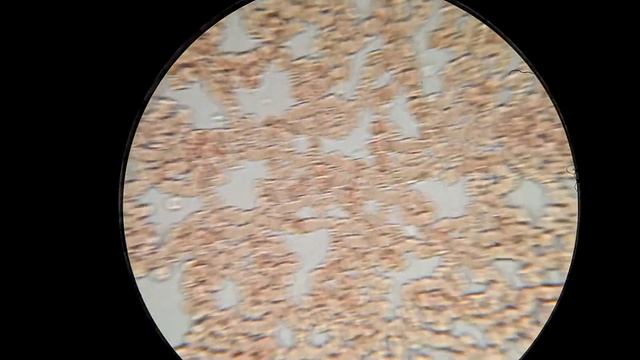 ПОДСОЛНЕЧНОЕ масло повлияло на мою кровь смотреть онлайн