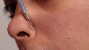 How I Clean Congested Pores on the nose [you should have one at home!]