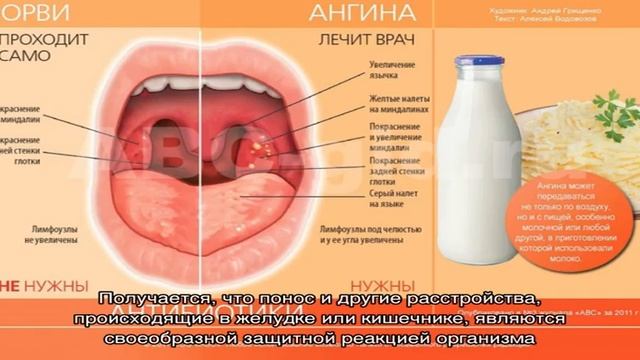 Может ли быть понос при ангине? смотреть онлайн