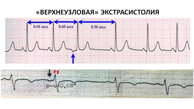 Гноевых ВВ_ПВБ_Электрокардиография смотреть онлайн