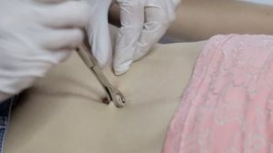 Обучающее Видео. ПРОКОЛ ПУПКА . Колесник Матвиенко Анна Навчальне відео. Прокол пупка.