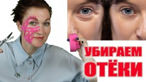 Отеки лица и вокруг глаз убираем! Без риска осложнений! Схема тейпирования.