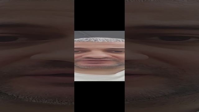 ПСОРИАЗ ЛЕЧИТСЯ!!! Ч.1