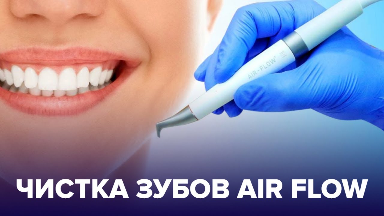 Профессиональная чистка зубов AIR FLOW - делать или нет?