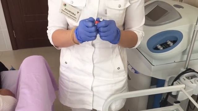 Коррекция морщин марионеток