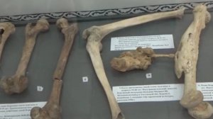 Донская кунсткамера. Травмы нижних конечностей в древности