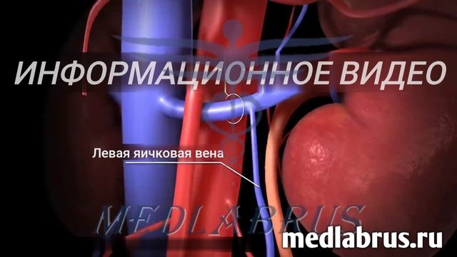 Варикоцеле - что это такое и как лечить ...