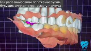 Никогда не лечил зубы, что можно сделать?